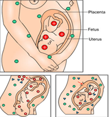 Anemia-in-pregnancy