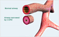 pharma for COPD