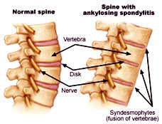 normal spine