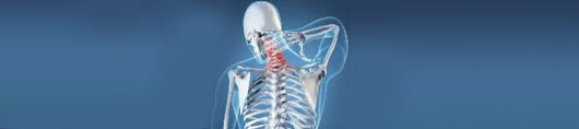 Cervical Spondylosis