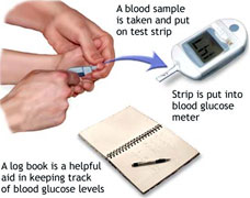 blood sample