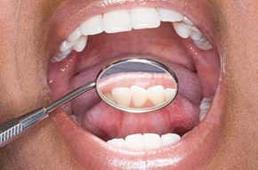 Dental Treatment