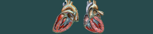 Endocarditis Top Banner