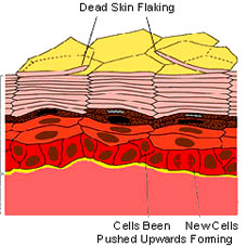 dead skin flaking