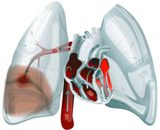 Patients with deep vein