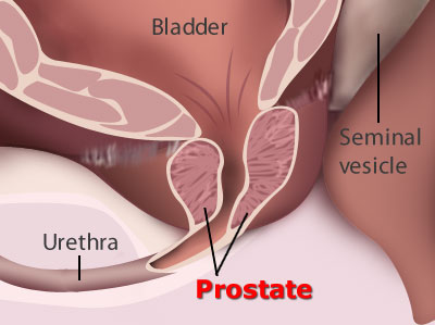 prostate