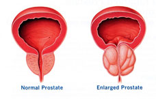 Normal Prostate