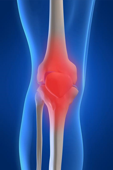 Taj Pharmaceutical Musculoskeletal System Index