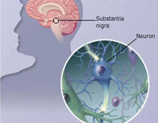 Pharmaceuticals Parkinson's Disease