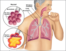 infection with bacteria