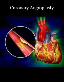 diseases angiography