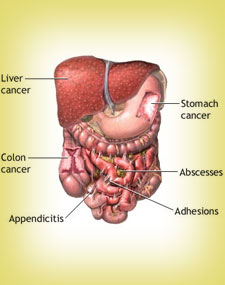 abdominal pharma