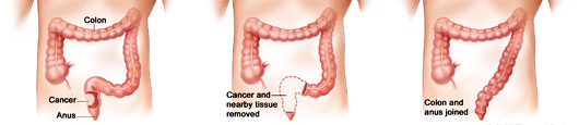 Anatomic Problems of the Colon