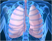 Lung cancer