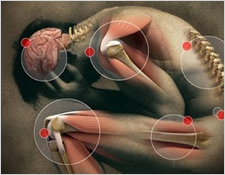 Parkinson's disease