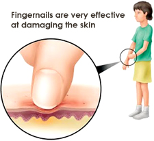 damaging-the-skin