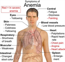 symptoms of anemia