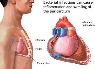 Clithrocin USP