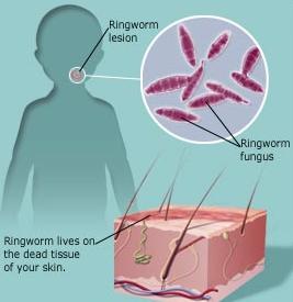 clithrocin